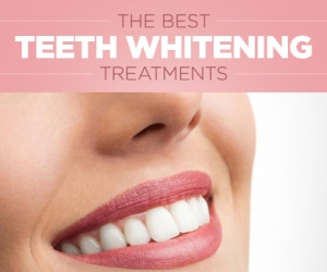 Tips to Achieve Whiter Teeth